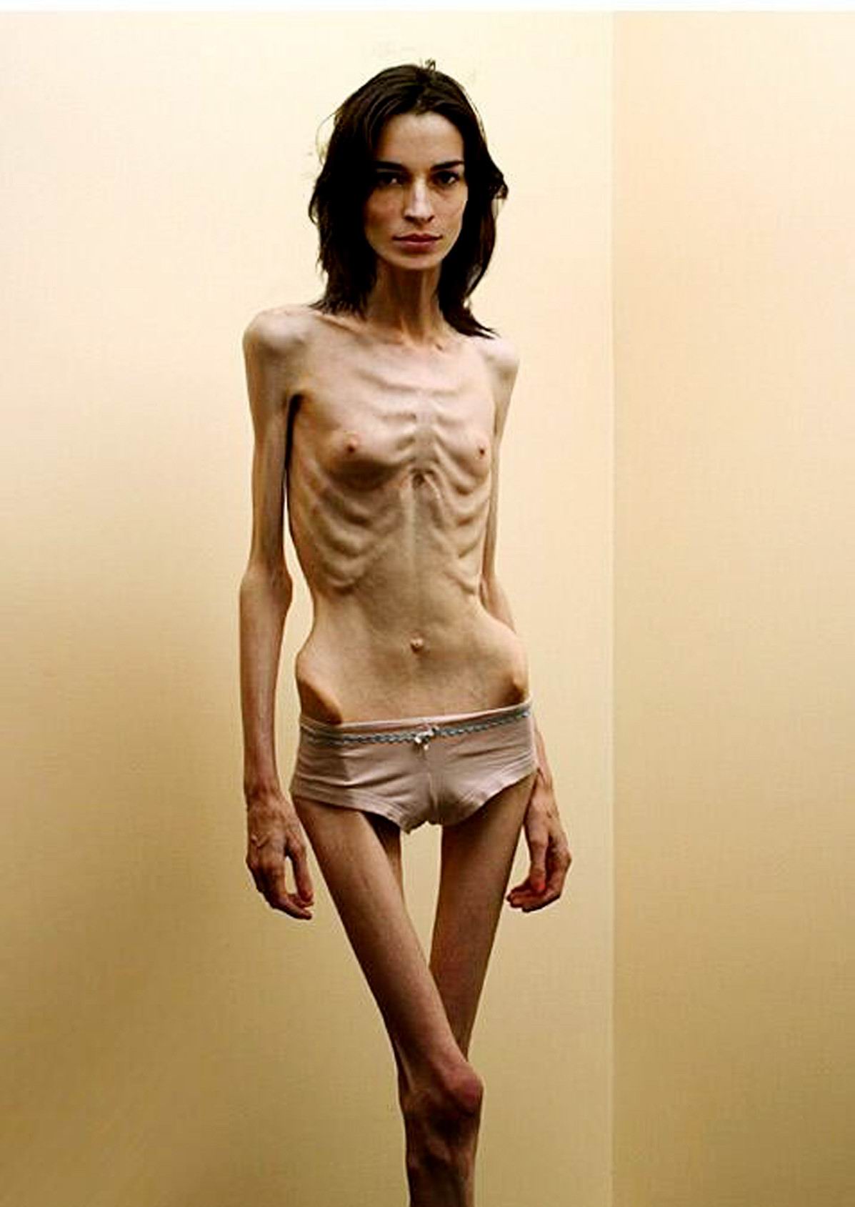 Free pictures and videos of anorexic teens 3